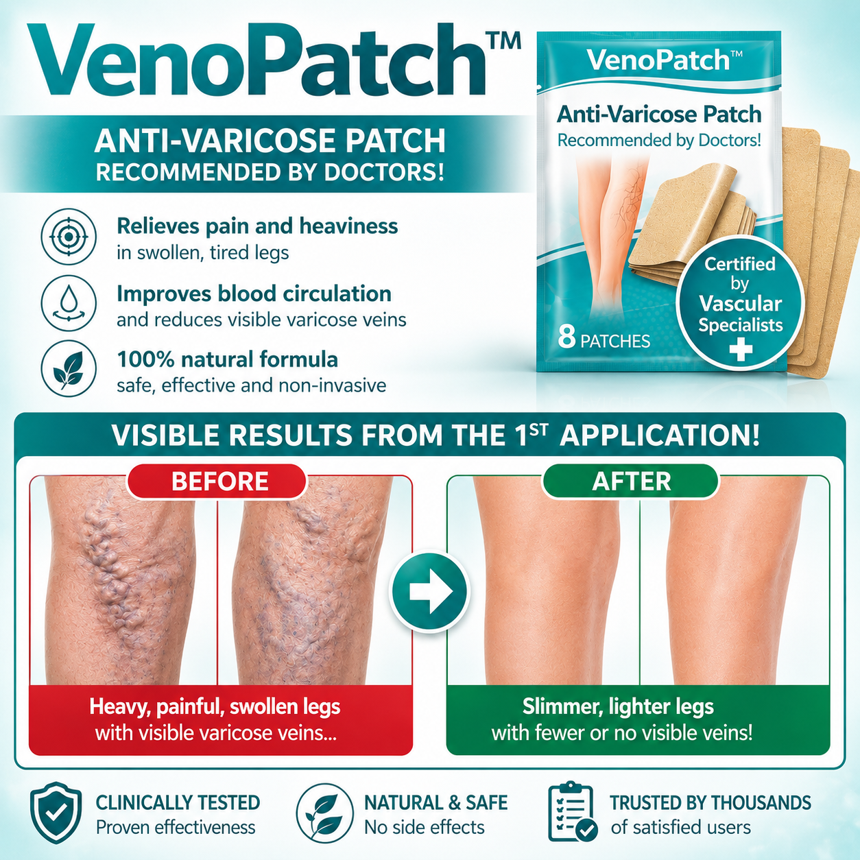 VenoPatch™ Anti-Varicose Patch | Make varicose veins and leg pain disappear in 3 minutes!